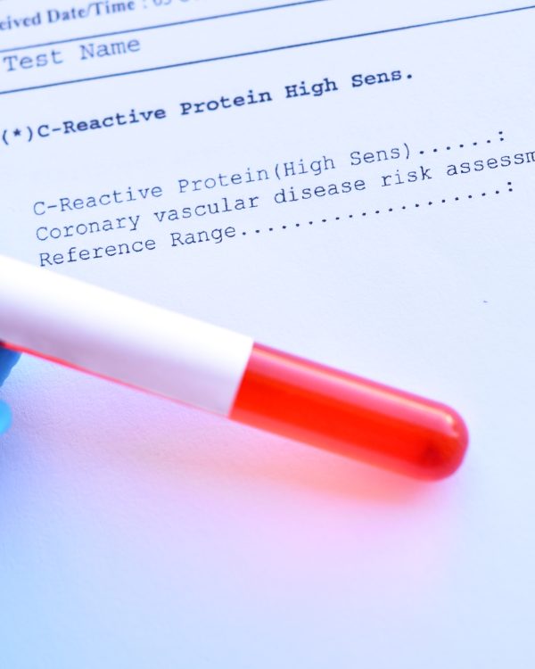 Can Tracking Biomarkers Help me Become Healthier?